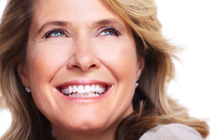 Woman With Porcelain Veneers