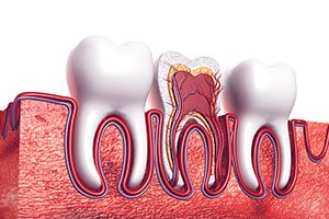 Tooth Cross Section